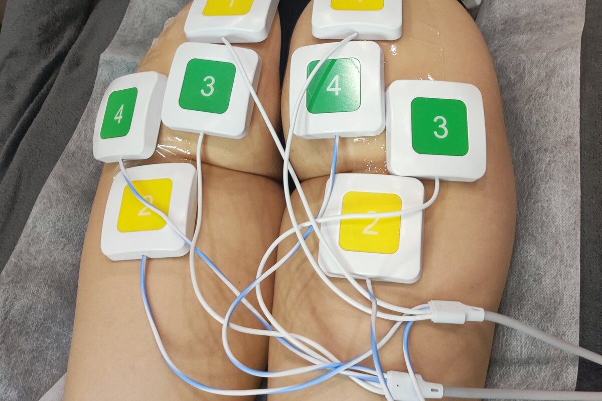 EMS prístroj Dr.Nek do vášho salóna